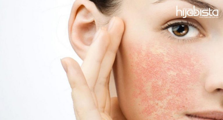 Jika Hijabi Ada Masalah Kulit Kering, Tolong Hindari Empat Bahan Ini Dalam Kandungan Produk Kecantikan.