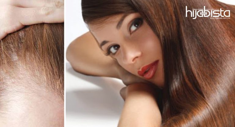 Rambut Lebat Selepas Buka Hijab, 10 Cara Mudah Ini Untuk Hijabi Yang Rambut Nipis. Harus Cuba!