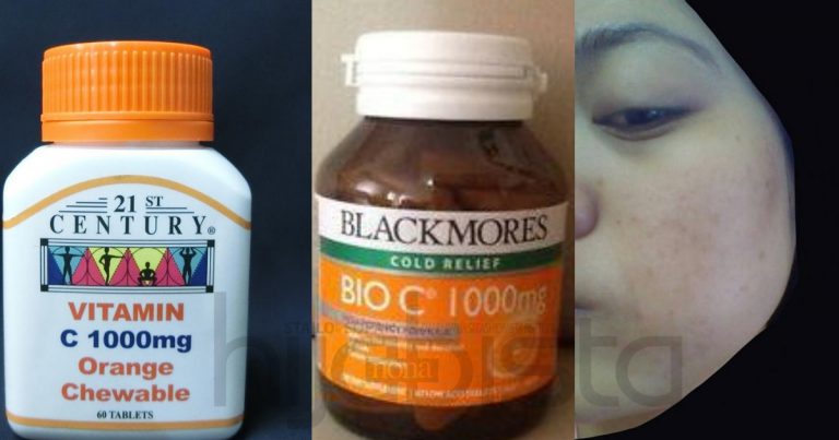 Wanita Ini Kongsi 15 Kebaikan Vitamin C Yang Wajib Hijabi Ambil Setiap Hari. Kulit Jadi Cantik & Berseri!