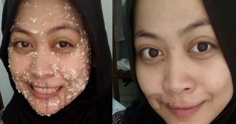 Hebatnya Penangan Skurb Beras Pulut Ini Jadikan Kulit Putih & Bersih Dalam Masa Sejam. Hasilnya WOW!