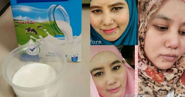 Nak Cantik Kena Rajin, Buat Sendiri Masker Beras Pulut Dengan Susu Confirm Wajah Berseri
