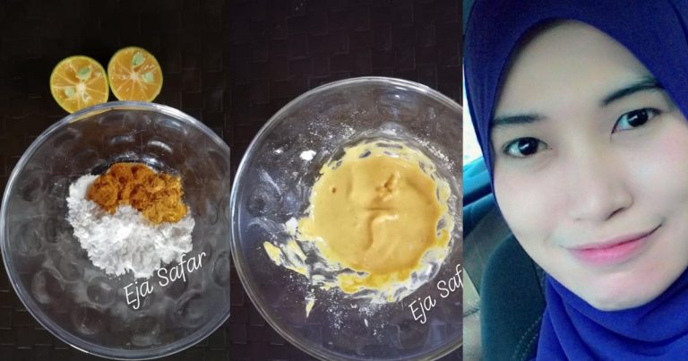 Mudahnya Hilangkan Parut Jerawat & Jeragat. Wanita Ini Kongsi Caranya Guna 3 Bahan Dapur Bajet RM5 Je!
