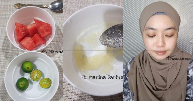 Wanita Ini Kongsi Cara Mudah Hilangkan Biji Kolesterol Di Wajah. Guna Dua Bahan Ni Je, Masalah Setel!