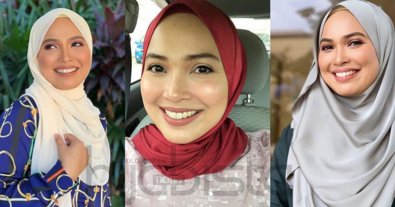 Pernah Alami Breakout Teruk, Farah Brep Brep Kongsi Petua Tradisional Pulihkan Wajah Hingga Jadi Flawless