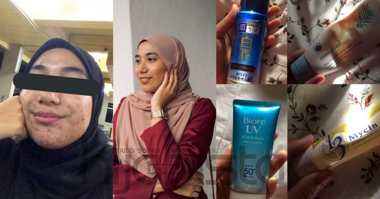 Kuat Semangat & Tak Peduli Kata Orang, Gadis Ini Kongsi Rutin Penjagaan Wajah Setelah 8 Bulan Alami Breakout