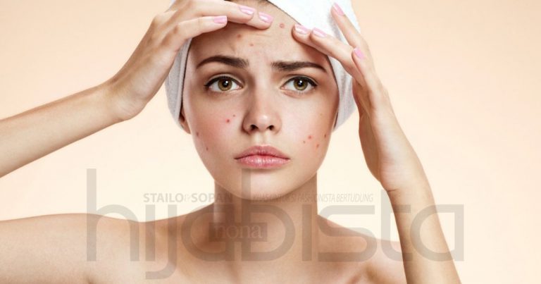 9 Kesan Menyakitkan Pada Wajah Tanda Produk Kecantikan Ini Tak Sesuai Untuk Anda. Elak Memakainya!