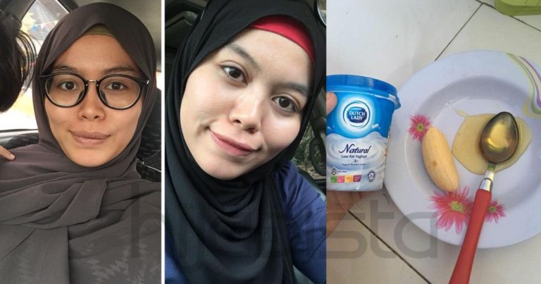 Wanita Ini Kongsi Diy Masker Hilangkan Jerawat & Dark Spot Guna Bahan Dapur Jadikan Kulit ‘Flawless’