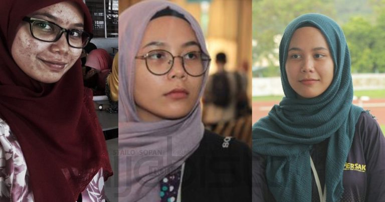 Pernah Breakout Teruk, Gadis Ini Pilih Produk Farmasi Untuk Pulihkan Wajah & Hasilnya Memang Menakjubkan!