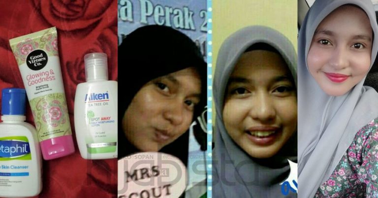 Dulu Wajah Kusam Teruk, Gadis Ini Akhirnya Berjaya Temui Produk Bersesuaian Buat Wajah Jadi Glass Skin