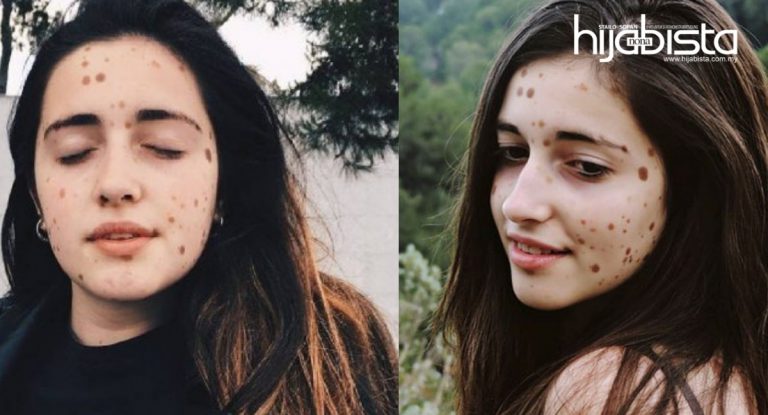 Ini Hukum Menghilangkan Tahi Lalat Menurut Islam. Amalkan Cara Alami Di Jamin Memang Selamat