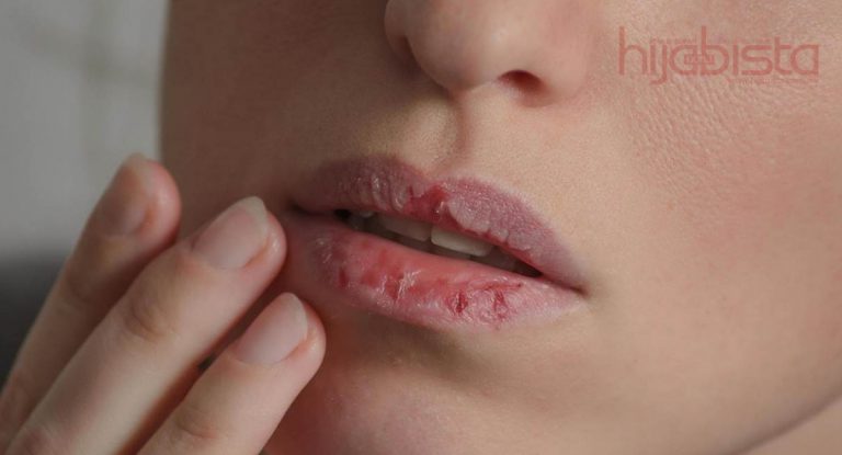 Bibir Pecah Dan Kering, Cuba Guna Skrub Kunyit Madu. Pasti Puas Hati Dengan Hasilnya!