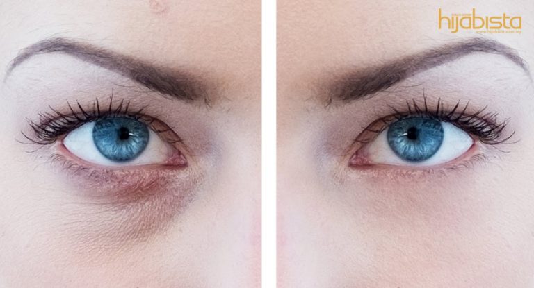 Lenyapkan Lingkaran Gelap Dengan Letak Hirisan Timun Bawah Mata & Hindari Wajah Kusam.