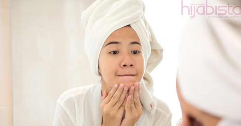 Lapan Cara Mudah Hilangkan Parut Pada Wajah, Bajet Pun Rendah