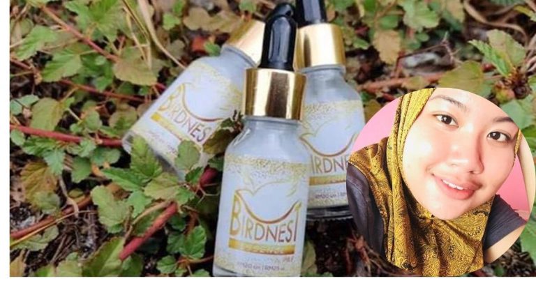 Tip Rawat Kulit Breakout Salah Satunya Pakai  Birdnest, Kulit Kusam Berminyak & Penuh Parut Jerawat Kembali Flawless