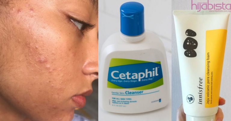 Stress Dan Rendah Diri Kerana Kulit Berminyak, Ini Cara Merawatnya Bagi Menjadi Flawless