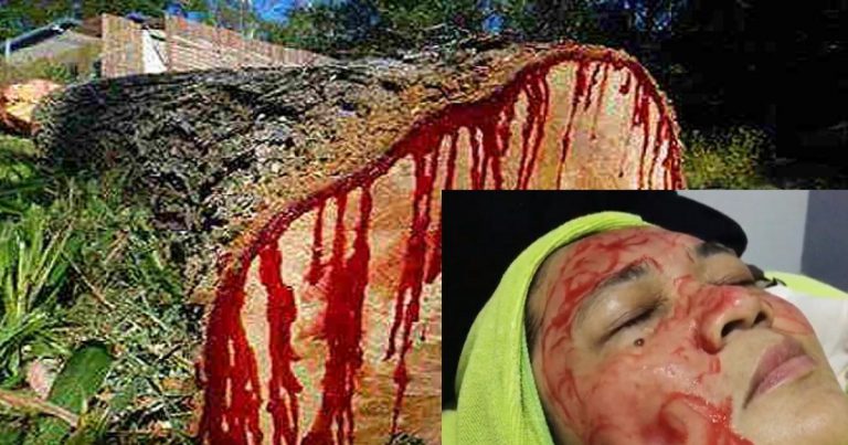 Rawat Kulit Rosak Dengan Esen Pokok Darah Naga, Barulah Kulit Wajah Kembali Glowing