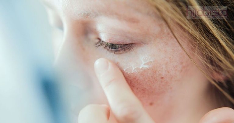 Gara-gara Pakai Produk Kosmetik Tidak Berdaftar, Wajah Rosak Teruk