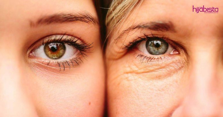 Hilang Terus Eyebag ‘Berat Berbakul’ Caranya Calit Vaseline Sebelum Tidur