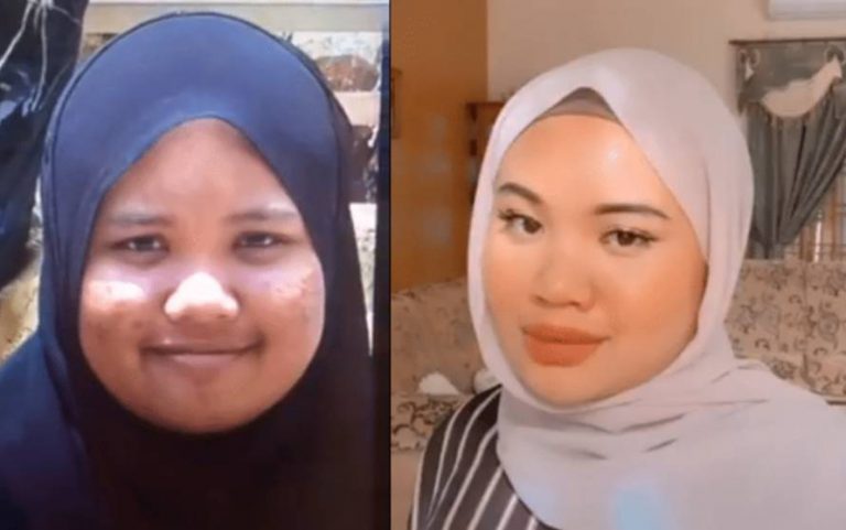 Gadis Ini Dedah Berat Badan Turun & Kulit Makin Flawless Lepas Tolak Air Manis 6 Bulan