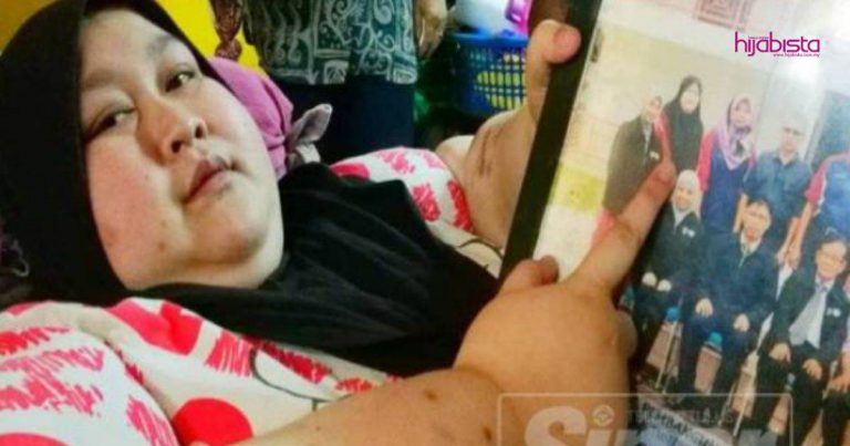 Derita Penyakit Misteri, Wanita Berat 200 Kg Meninggal Dunia