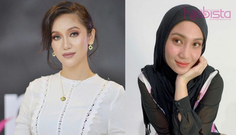 3 Tahun Ramona Finalis Dewi Remaja 2012 Suffer Dengan Muka Sendiri. “Rasa Macam Nak Kikis Muka”
