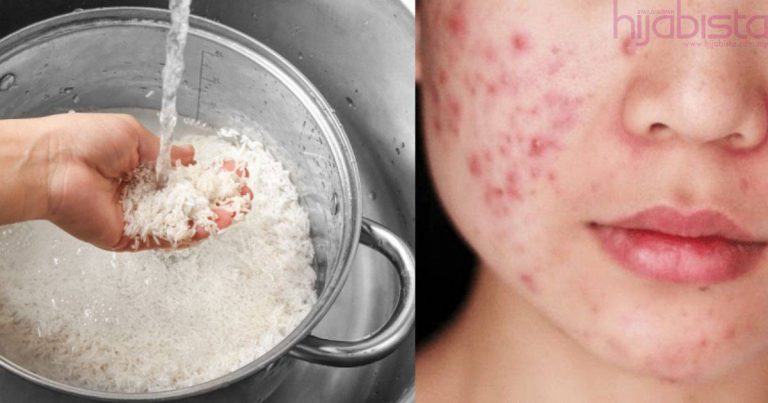 Guna Air Basuhan Beras Je Bagi Atasi Kulit Berminyak. Hilangkan Jerawat Pun Boleh