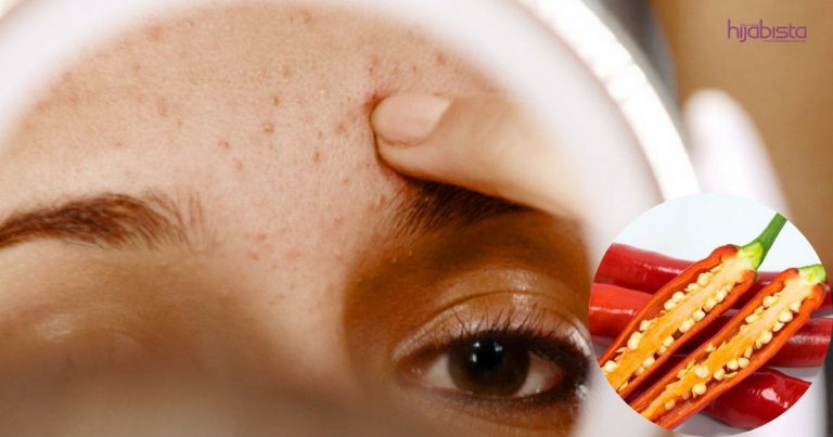 Makanan Pedas Boleh Jadi Penyebab Jerawat Tumbuh, Benar Atau Mitos