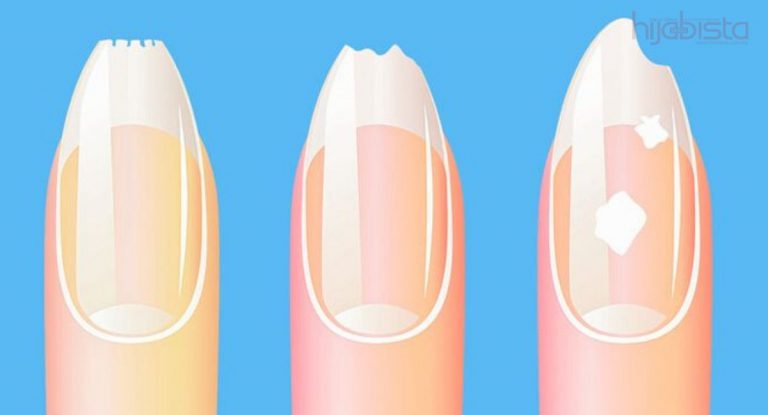 Perubahan Pada 8 Bahagian Muka Ini, Rupa-Rupanya Menunjukkan Anda Punya Penyakit Dalaman. Hati-hati!