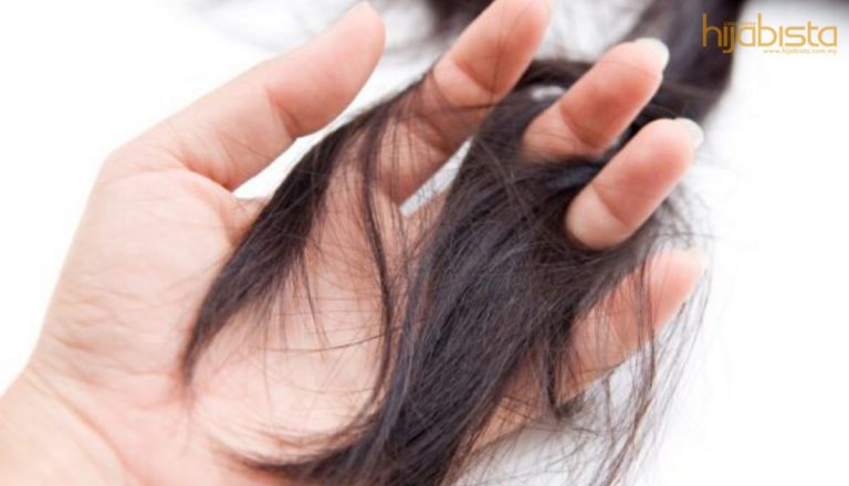 Gadis Ini Kongsi Produk Yang Selesaikan Masalah Rambutnya Gugur Yang Hampir Nak Botak