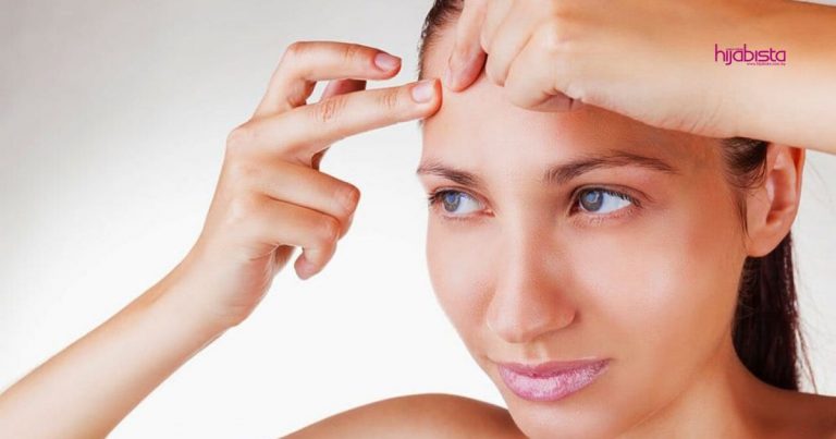 Bukan Biasa-biasa Jerawat Tumbuh Pada Wajah, Mungkin Petunjuk Organ Dalaman Tak Sihat