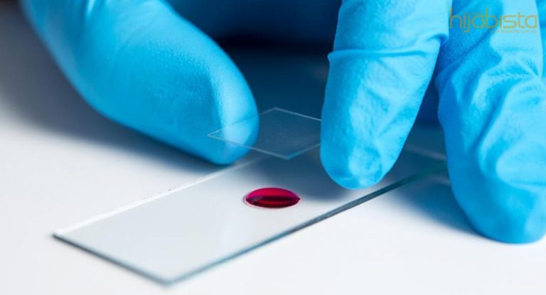 Individu Mempunyai Darah Jenis A Harap Berhati-hati. Virus Mudah Terdedah Pada Golongan Ini