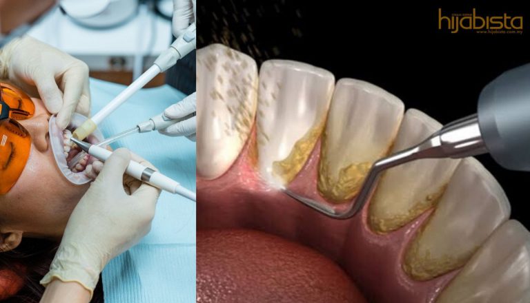 Rawatan Gigi Macam Spa! Menepis Mitos Sakitnya Scaling Gigi. Ini Nasihat Dr Mike