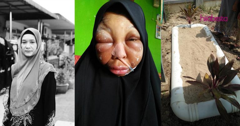 “Mak Dah Kembali Ke Rahmatullah Pagi Tadi”- Pesakit Kanser Lidah Tahap 4 Meninggal Dunia,