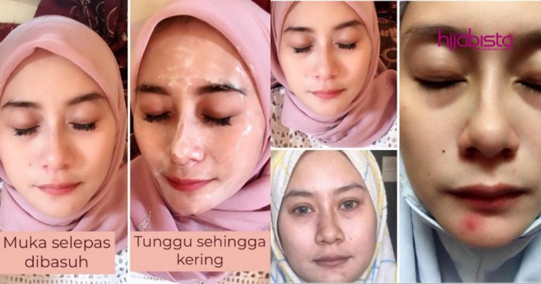 Makan Hati Tengok Kulit Orang Lain Nampak Glowing, Guna Je Tepung Beras & Susu Tepung