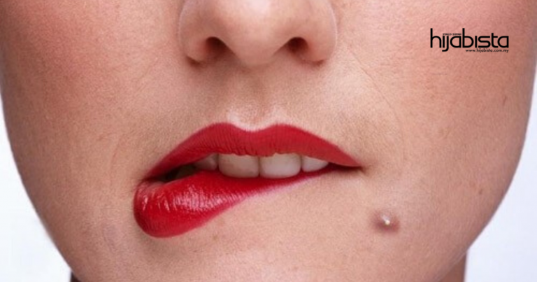 Tertanya-tanya Kenapalah Jerawat Asyik Tumbuh, Pelik Betul!