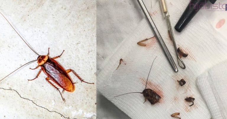 Seramnya! Netizen Terkejut Lihat Doktor Keluarkan Lipas Dari Telinga Pesakitnya