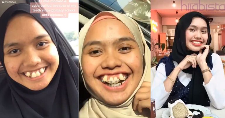 Dulu Sering Diejek Kerana Giginya, Tetapi Lihatlah Perubahannya Kini!