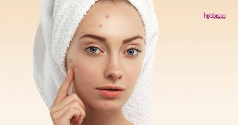 Wanita Ini Kongsi Step Recover Wajah Yang Sedang Breakout, Siap Share Skrub DIY Guna Beras & Kunyit