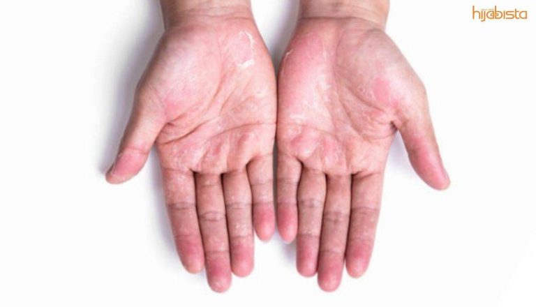 Sarung Tangan Rawatan Terbaik Untuk Melembapkan Tangan Kering dan Basah Disebabkan Kekerapan Cuci Tangan