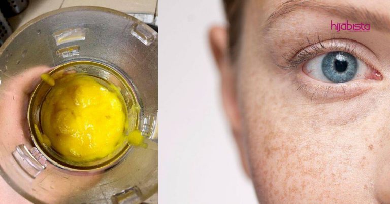 Jeragat Hilang Dengan Masker DIY, Pakai Seminggu 4 kali Tak Lebih 15 Minit