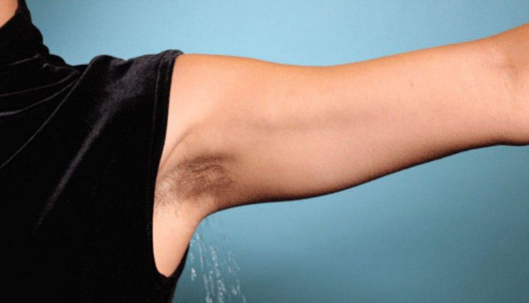 Hilangkan Hitam Dan Bau Ketiak Dengan Cara Alami. Ini 5 Manfaat Tawas Ramai Yang Tidak Tahu