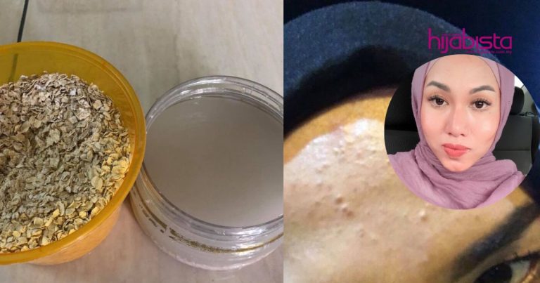 Parut & Jerawat Hilang Dengan Cara Spray Oat Pada Wajah, Hasilnya Kulit Kembali Glowing Berseri