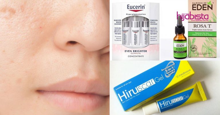 Senarai Semak Produk Hilangkan Parut Jerawat Terbaik Di Pasaran, Barulah Wajah Kembali Berseri