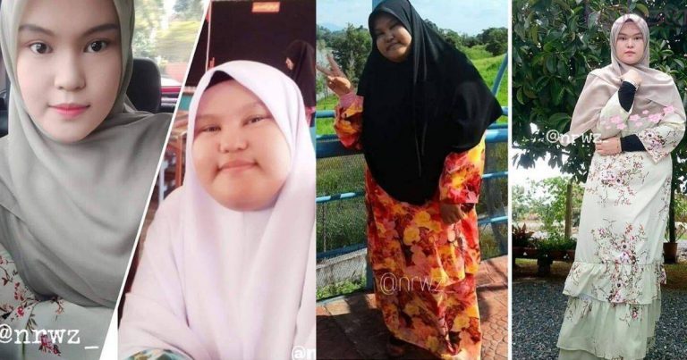 Berjaya Turun Hampir Separuh Berat Badan, Gadis Ini Tak Lokek Kongsi Tip Yang Diamalkannya