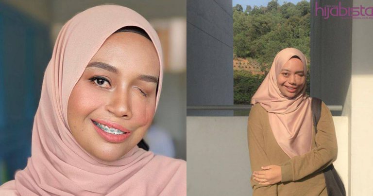 Gadis Tanpa Sebelah Mata Curi Perhatian Ramai Bila Disolek Oleh MUA Terkenal. Sangat Menawan!