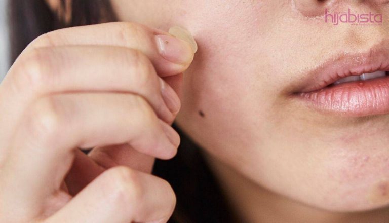 13 Penampal Ajaib Terbaik Untuk Menyembuhkan Dan Mengurangkan Jerawat, Menurut Ahli Dermatologi