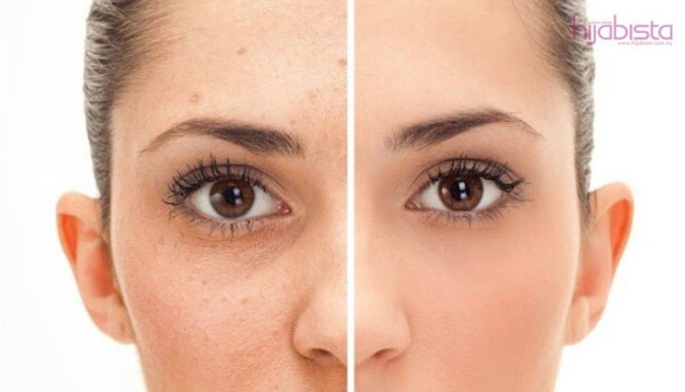 7 Penjagaan Kulit yang Berpatutan Untuk Mengatasi Belang Muka Di Sebalik Hijab