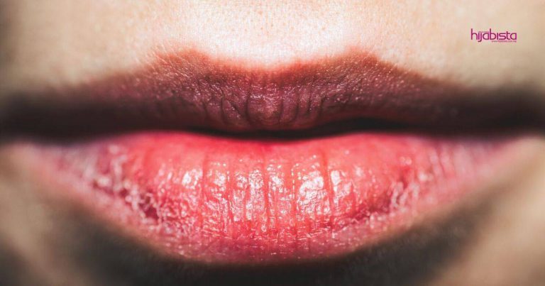 Wanita Ini Kongsi Tip Elak Bibir Gelap, Kering & Merekah, Salah Satunya Guna Lip Sleeping Mask