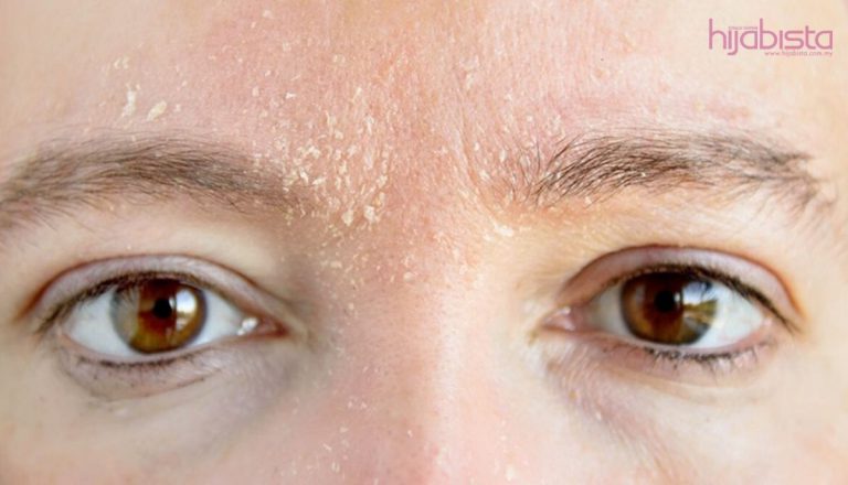 Kulit Tegang Dan Semakin Kering Lepas Cuci Muka, Tidak Lagi Dengan 10 Pencuci Muka Ini Cadangan Pakar