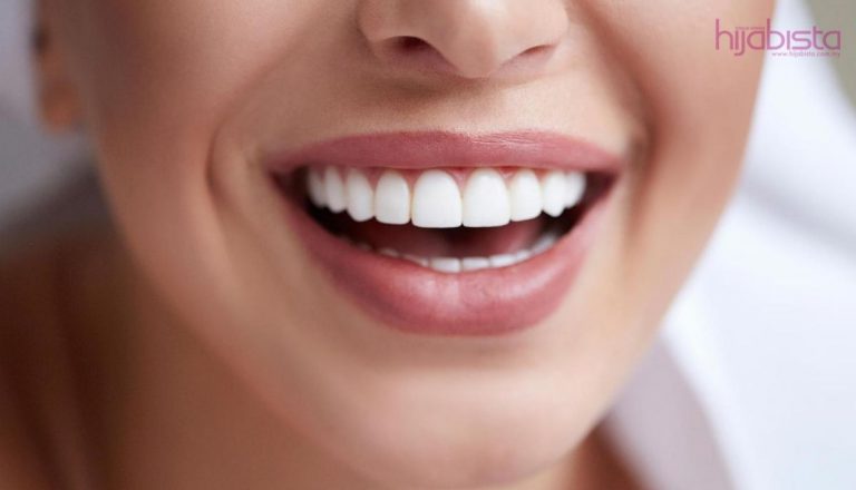 Penting Pilih Warna Lipstik Untuk Dapatkan Gigi Tampak Putih Agar Tampil Lebih Sempurna